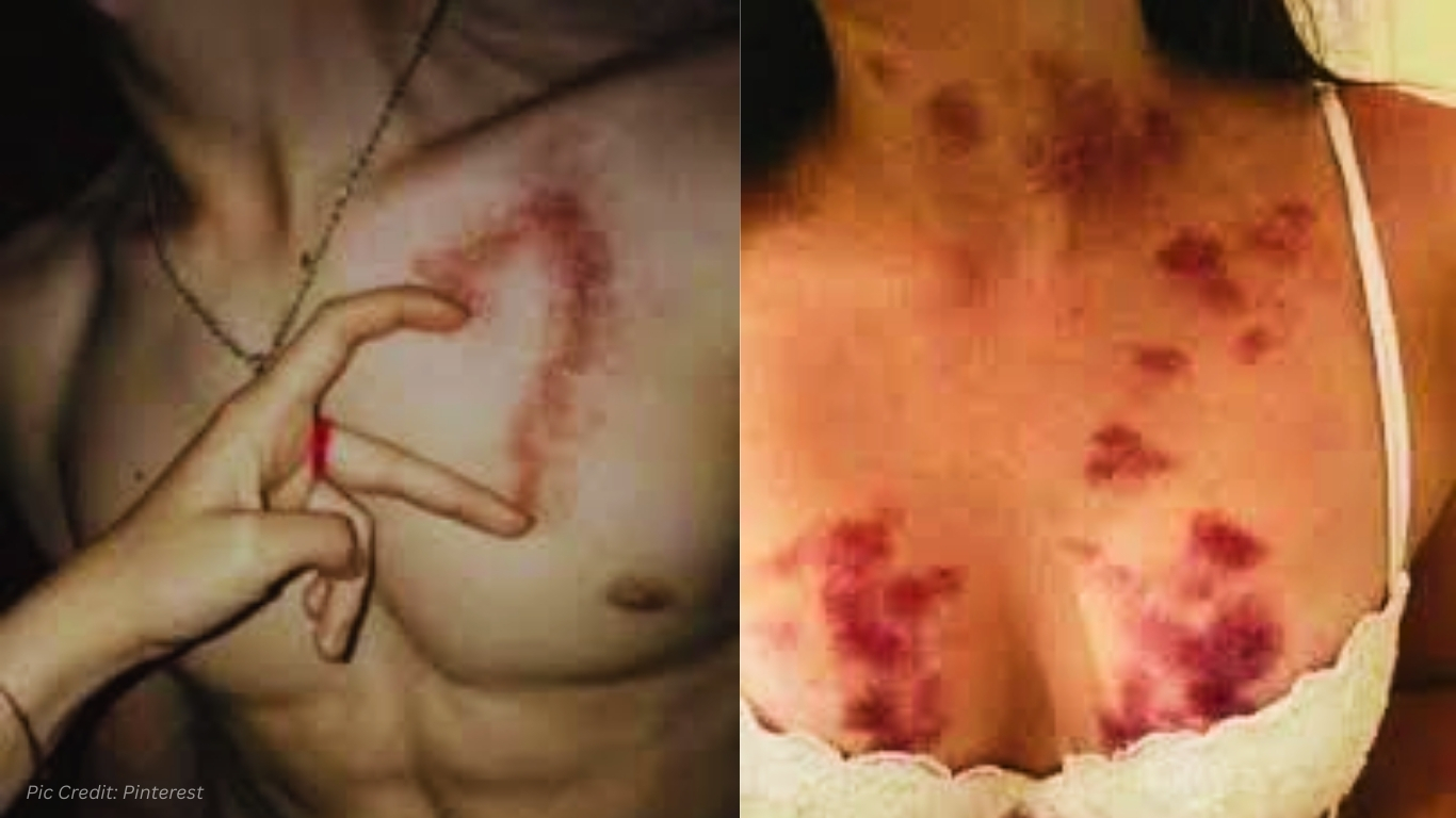 How to Give a Love Bite Safely and What to Know Before Trying - DESIRE